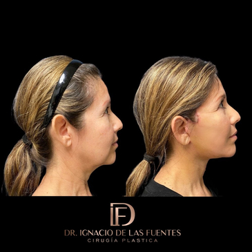 Slider image (2) Dr. Ignacio De Las Fuentes